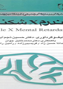 Fragile X Syndrome
